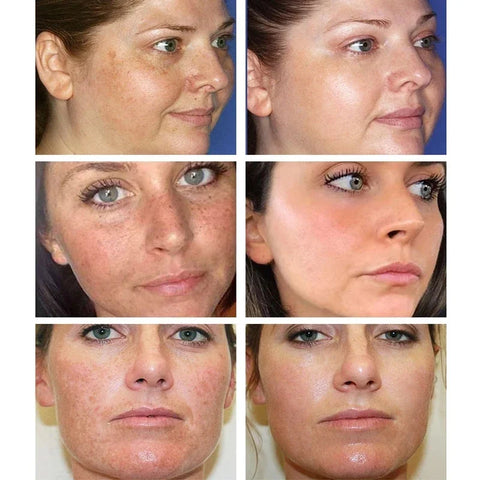 Beyprern Vitamin C Face Cream Remove Dark Spots Whitening Cream Face Fade Spots Moisturizing Anti-Aging Firming Brightening Skin Care