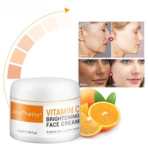 Beyprern Vitamin C Face Cream Remove Dark Spots Whitening Cream Face Fade Spots Moisturizing Anti-Aging Firming Brightening Skin Care
