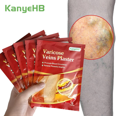 18pcs/3bags Varicose Veins Treatment Plaster Varicosity Angiitis Patch Relief Veins Pain Phlebitis Medical Health Care Plaster
