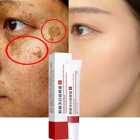 Beyprern Whitening Freckle Cream Remove Melasma Face Cream Dark Spots Melanin Remover Moisturizing Brighten Nourishing Smooth Skin Care