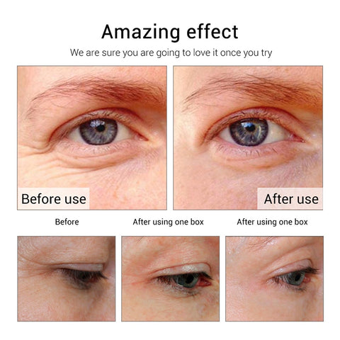 Peptides Ageless Instantly Eye Cream Hyaluronic Acid Serum Essence Gel for Firming Wrinkles Whitening Puffy Eye Care 20g