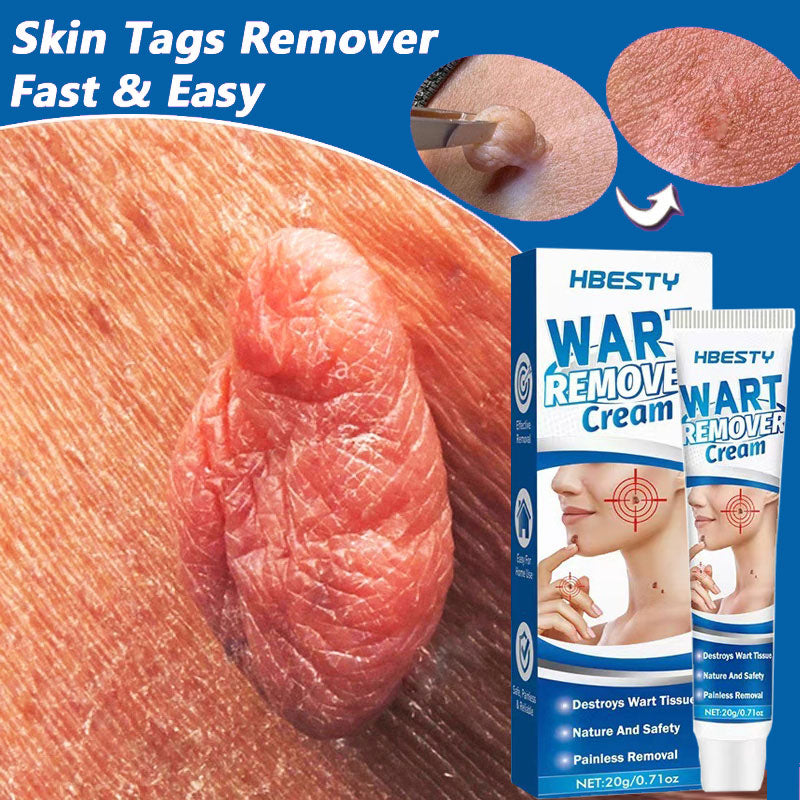 Skin Tag Remover Cream Mole Skin Dark Spot Warts Remover Serum Painless Freckle Face Wart Tag Treatment Removal 20g EssentialOil