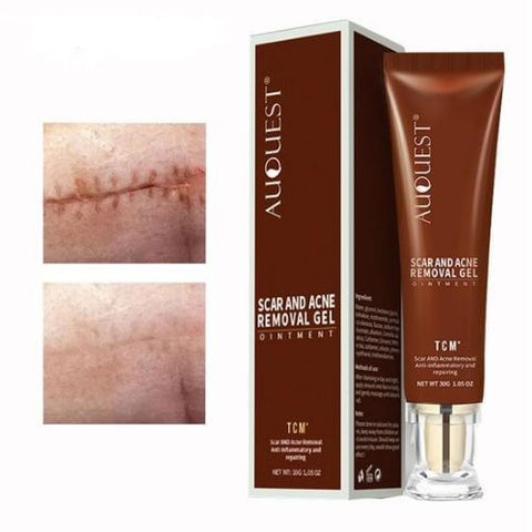 Beyprern Stretch Marks Scar Repair Cream Acne Remove Promote Cell Regeneration Freckles Spots Removal Skin Care