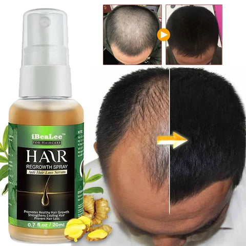 Beyprern 5PCS Hair Growth Essential Oils Hair Care Essence Improve Hair Loss Treatment Liquid Beauty Dense Hairs Growth Serum Health Care
