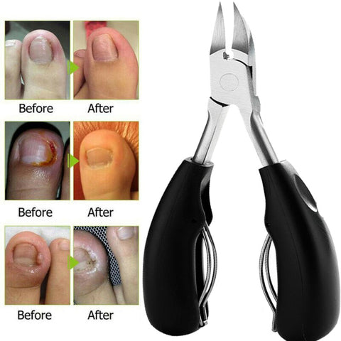 Beyprern Nail Clippers Toenail Pedicure Manicure Tools Anti-Splash Ingrown Paronychia Professional Correction Tool Dead Skin Scissors 1PC