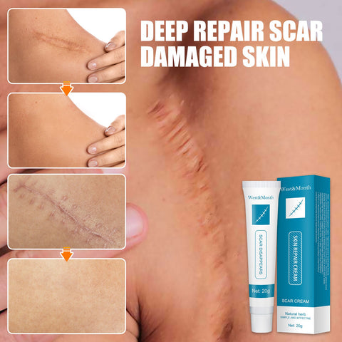Beyprern Acne Scar Removal Cream Repair Pimples Stretch Marks Gel Remove Burn Surgical Scar Whitening Moisturizing Smooth Body Skin Care