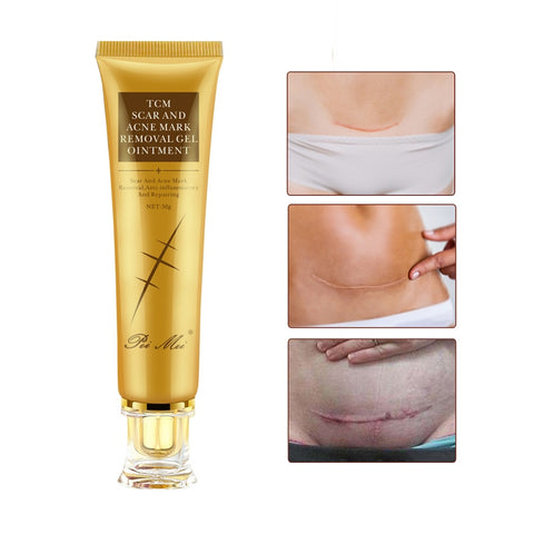 Removal Scar Cream Face Pimples Scar Stretch Marks Removal Acne Treatment Whitening Moisturizing Cream Skin Care