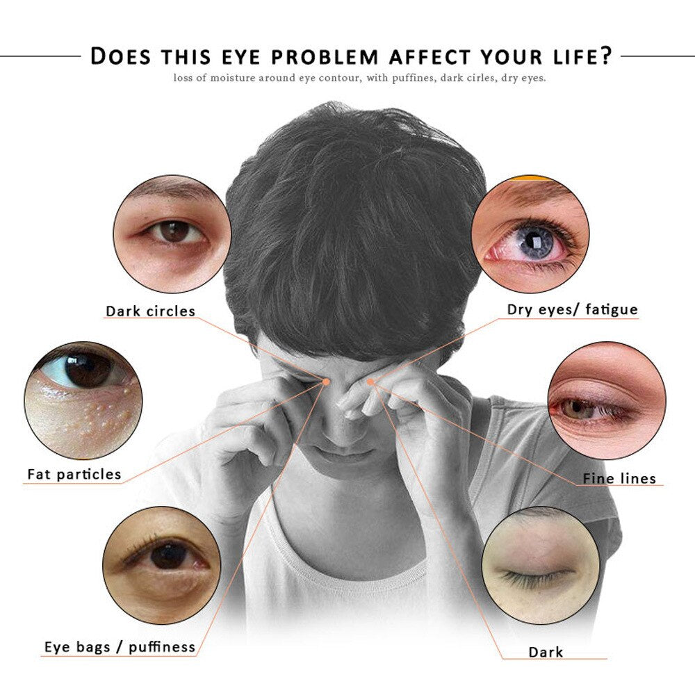 30ml Vitamin E Eye Serum Lasting Moisturizing Fades Dark Circle Whitening Eye Essence Anti Wrinkle Anti Aging Skin Care Product