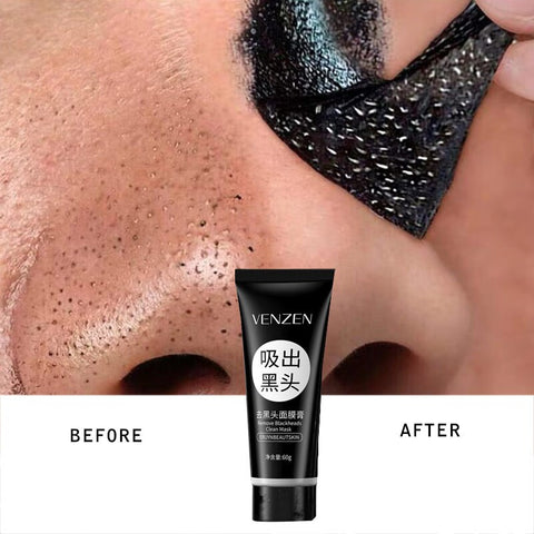 Remover Blackhead Clean Mask Blackhead Facial Mask Acne Treatment Oil-Control Deep Cleansing Peel-Off Face Black Mask Face Care