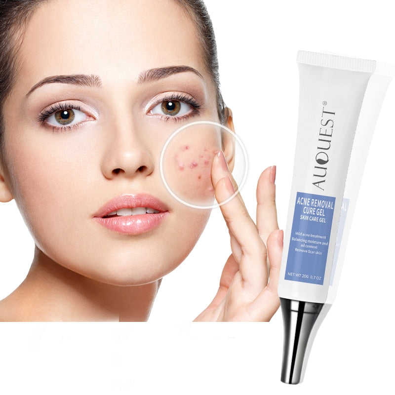 Acne Treatment Face Cream Oil Control Whitening Moisturizing Anti Acne Cream Skin Care 20g