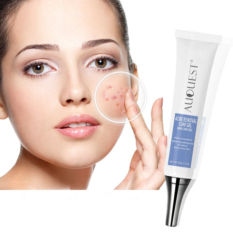 Acne Treatment Face Cream Oil Control Whitening Moisturizing Anti Acne Cream Skin Care 20g