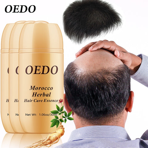 Buy 3 Get 1 Gift Ginseng Hair Care Essence Repair hair follicles Reduce bifurcation Fast Powerful Hair Growth Serum