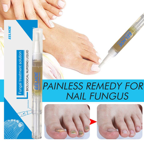 Beyprern Fungal Nail Treatment Feet Care Serum Toe Fungus Pen Nail Cuticle Oil Anti Infection Paronychia Onychomycosis Nourish Foot Care