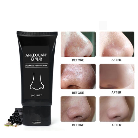 Blackhead Remover Face Mask Oil-Control Nose Black Dots Mask Acne Deep Cleansing Beauty Cosmetics for Women Skin Care