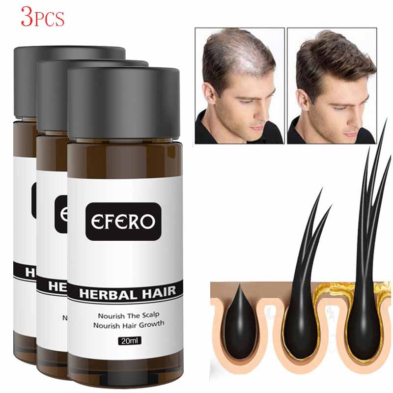 3PCS Hair Growth Products Ginger Essential Oil Serum Anti Hair Loss Treatment Fast Grow Repair Dry Frizzy Damaged Thinning Care