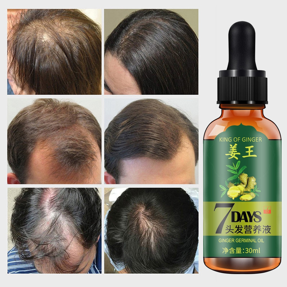 Hair Growth Ginger Essence Hair Loss Products Essential Oil Liquid Repair Preventing Hair Loss Nourishing Hair Care Products