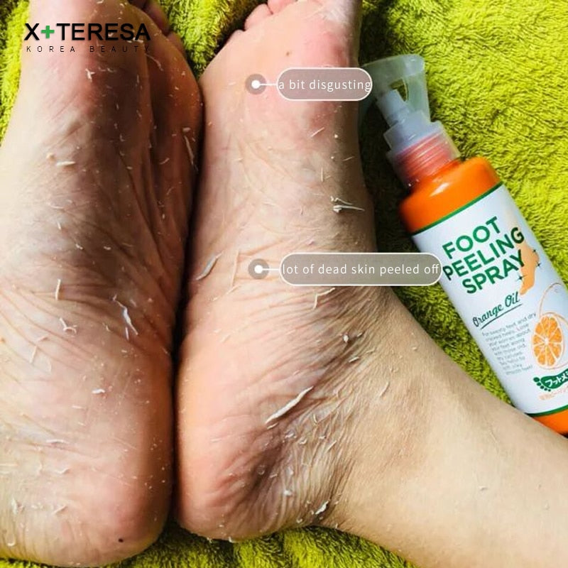 Christmas gift Japan Cosmetics Foot Peeling Spray Natural Orange Essence Pedicure Hands Dead Skin Exfoliator Mask Whiten Baby Foot Care Tool