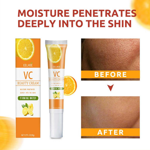 Vitamin C Whitening Freckle Remove Effectively Remove Stains Spots Blemish Whitening Serum Face Skin Care Anti Freckle Heathly