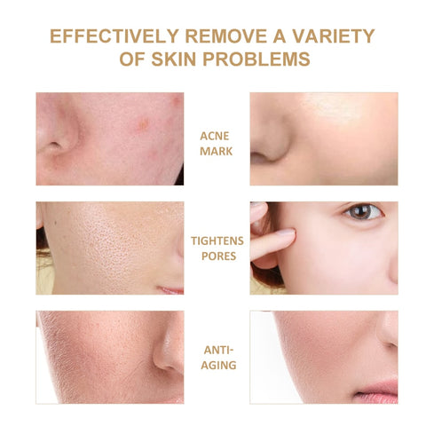 Snail Face Cream Collagen Anti-Wrinkle Aging Facial Day Cream Hyaluronic Acid Moisturizer Nourishing Tight Skin Care