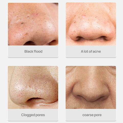 Blackhead Remover Nose Masks Skin Care Pore Strip Tearing Black Mask Acne Peeling Treatment Deep Cleansing Cosmetics 30g