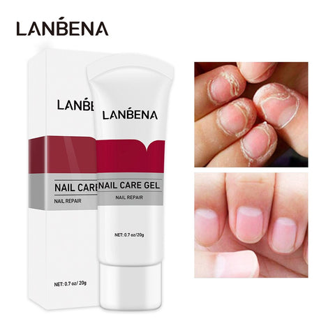 LANBENA Nail Care Gel Fungal Nail Treatment Remove Onychomycosis Nail Care Nourishing Effective Against Nail Hand And Foot Care
