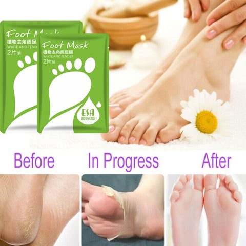Description Soak your feet in warm water for 10-15 minutes before use Put a mask on each foot and fix it with tape You can wear