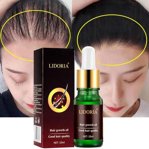 Hair Growth Essential Oil Products Polygonum Anti Hair Loss Treatment Serum Dry Frizzy Damaged Thinning Hair Scalp Beauty Care