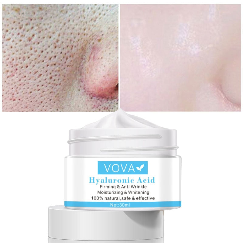 Pore Shrinking Cream Hyaluronic Acid Pores Treatment Relieve Dryness Oil-Control Firming Moisturizing Repairing Smooth Skin Care