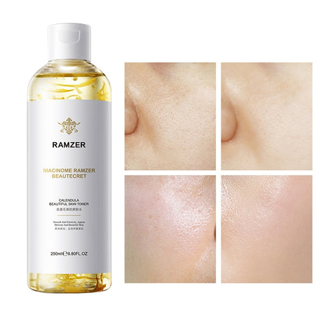 Calendula Beautiful Skin Toner Moisturizing Improve Dry Face Essence Sooth Sensitive Skin Oil-control Shrink Pores Facial Toner
