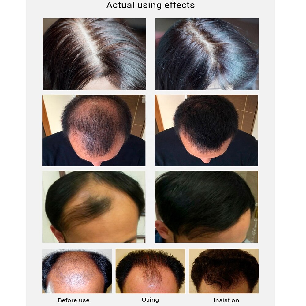 Hair Care Hair Growth Essential Oils Dense Hair Growth Serum Fast Hair Growth Treatment Oil