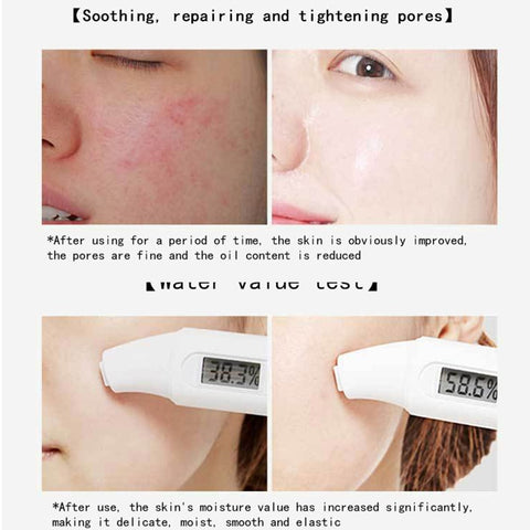3g * 20pcs Moisturizing Sleeping Mask Centella Jelly Deep Hydrating Nourishing Repairs After Sun Exposure Facial Skin Care TSLM1