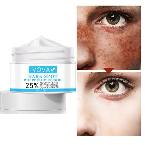 Powerful whitening cream Chinese face cream to remove freckles and dark spots 30g facial skin care whitening cream