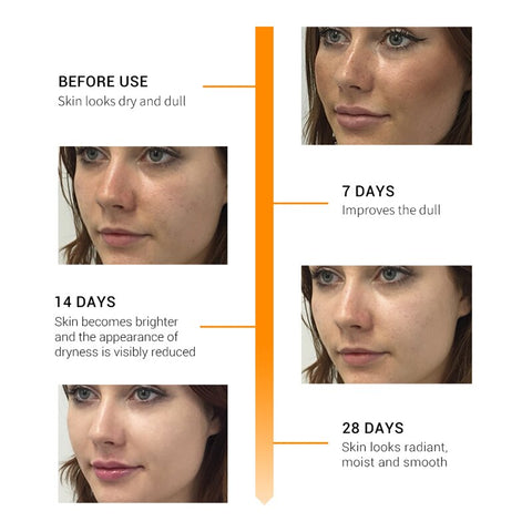 Vitamin C Serum Whitening Face Care Cosmetics Fade Freckles Melanin Remover Moisturizing Brighten Nourish Skin Care Products