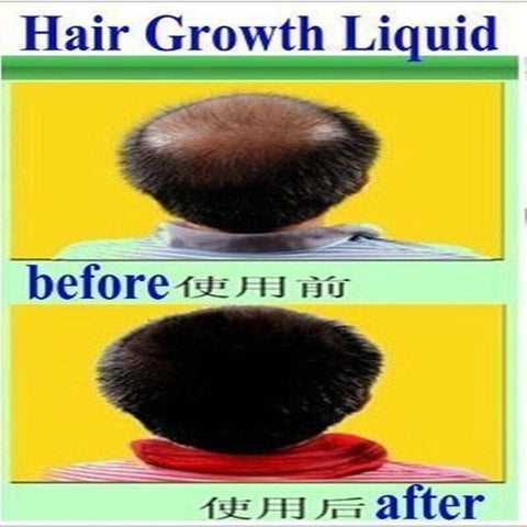 Andrea 20ml Ginger Extract Dense Hair Fast Sunburst Hair Growth Essence Restoration Hair Loss Liquid Serum Hair Care Oil