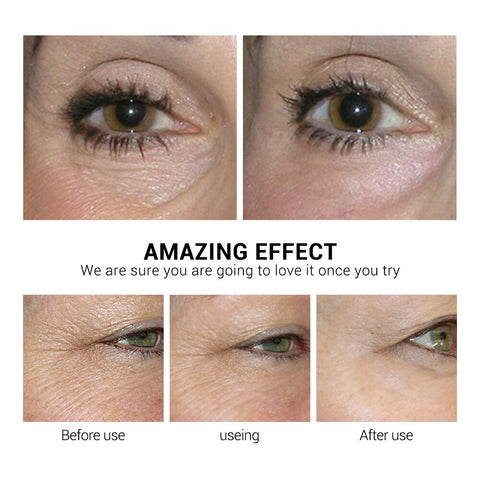LANBENA Retinol Eye Mask Eye Patch Reduces Dark Circles Ageless Anti-Puffiness Lifting Firming Eye Serum Cream Skin Care 50PCS