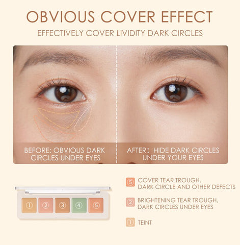 Five Color Concealer Palette Natural Long Lasting Face Makeup Cover Dark Circles Acne Cosmetics Maquillaje TSLM1