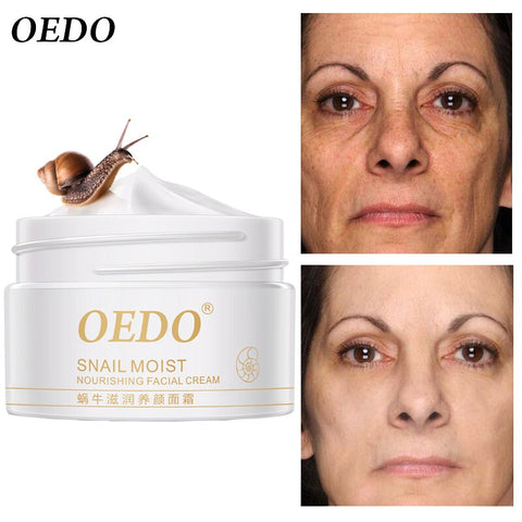 OEDO Hyaluronic Acid Anti Aging Peptide Collagen Eye Cream Against Bags Snail Face Cream Whitening Essence Firming Care Cream
