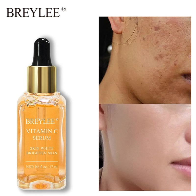 Vitamin C Serum Whitening Face Care Cosmetics Fade Freckles Melanin Remover Moisturizing Brighten Nourish Skin Care Products