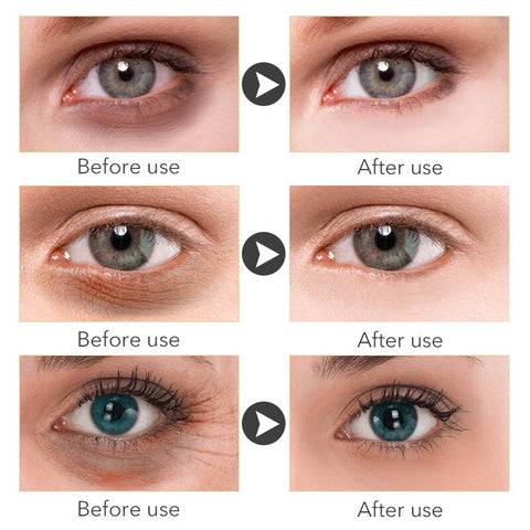Retinol Anti-Wrinkle Eye Serum Hyaluronic Acid Moisturizing Fades Fine Lines Dark Circles Removal Gel Firming Brighten Cosmetics