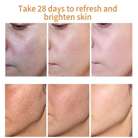 Beyprern Vitamin C Whitening Face Serum Fade Freckles Melanin Remover Skin Care Products Moisturizing Brighten Nourish Beauty Cosmetics