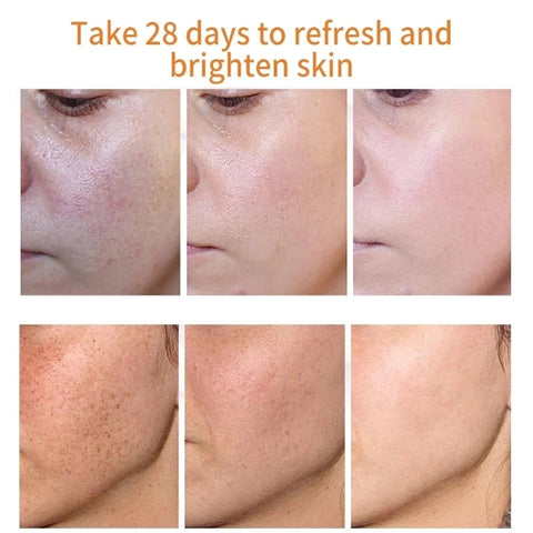 Beyprern Whitening Freckle Cream Remove Melasma Face Cream Dark Spots Melanin Remover Moisturizing Brighten Nourishing Smooth Skin Care