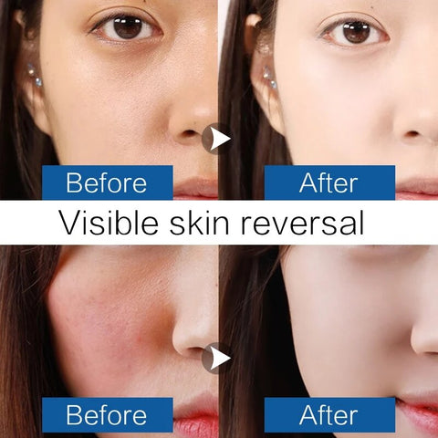 5Pieces Seaweed Face Mask Algae Alginate Moisturizing Whiten Korean Facial Skin Care Shrinkage Pores Oil-control Beauty Masks