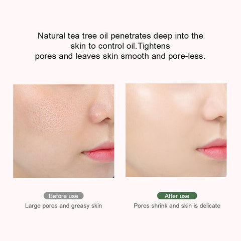 BREYLEE Pore Refining Gel Shrink Pores Cream Serum Moisturizing Firming Dry Skin Care Anti Aging Oil Control Facial Essence 40g
