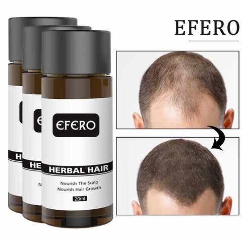 3PCS Hair Growth Products Ginger Essential Oil Serum Anti Hair Loss Treatment Fast Grow Repair Dry Frizzy Damaged Thinning Care