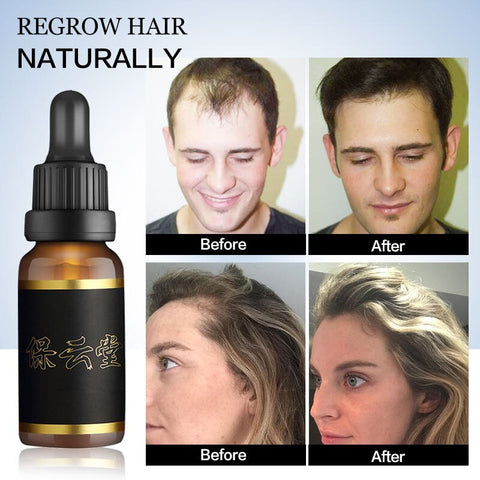 Hair Growth Serum Essence Oil for Fast Hair Growth Anti Hair Loss Treatment Ginger Hair Loss Products for Women Men Hair Tonic