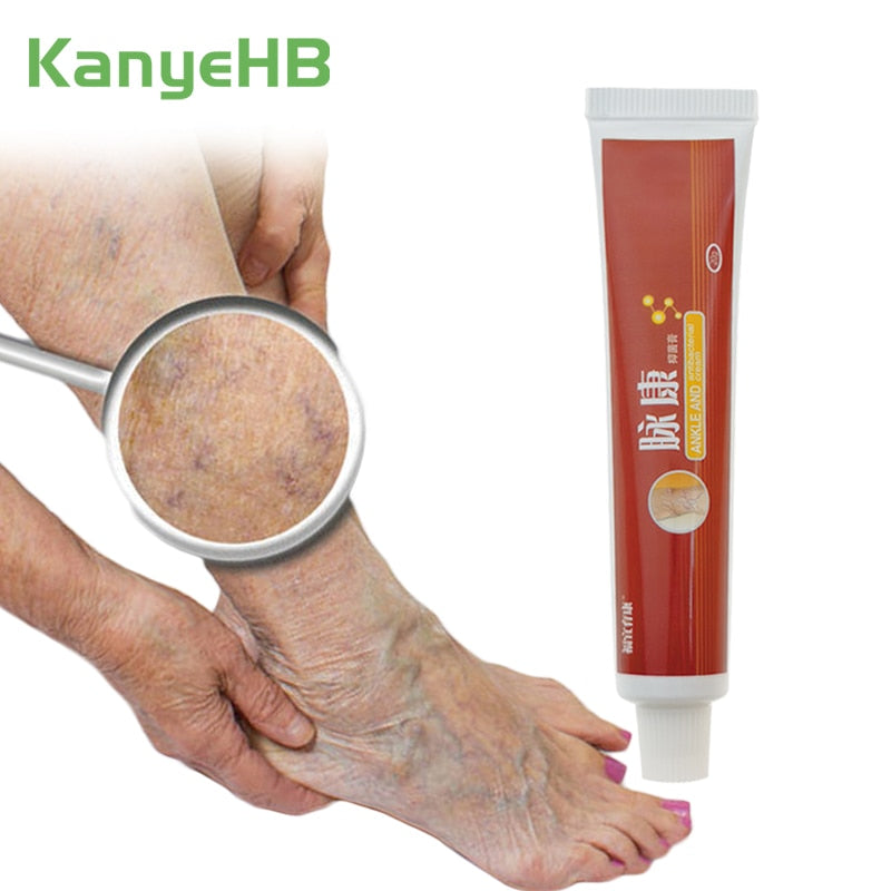 Beyprern 1Pcs Treatment For Varicose Veins Chinese Herbal Medicine For Varicosity Angiitis Removal Phlebitis Leg Veins Pain Ointment S034