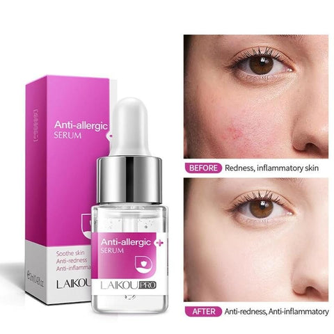 Anti-allergic Serum Chinese Herbal Anti-sensitive Anti-redness Facial Essence Shrink Pore Soothe Skin Treat Acne Face Serum 12ml