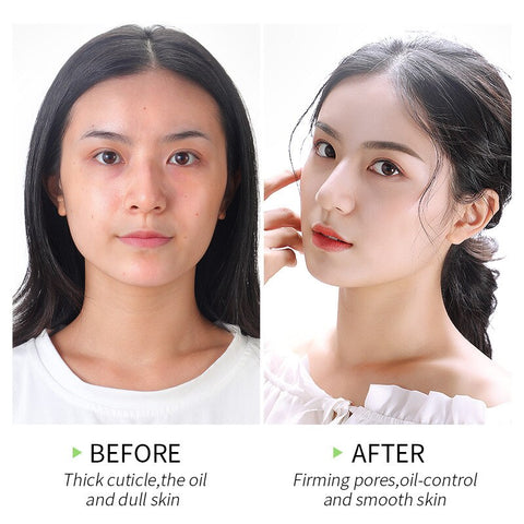 LAIKOU Matcha Exfoliating Peeling Gel Facial Scrub Moisturizing Whitening Nourishing Repair Scrubs Face Cream Beauty Skin Care