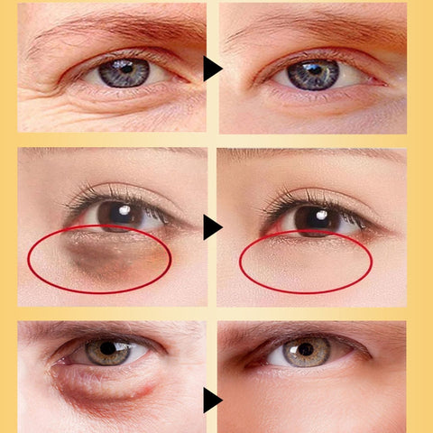 Golden Eye Serum Remove Dark Circles Eye Bags Korean Cosmetics Hyaluronic Acid Moisturizing Gel Brighten Anti-Wrinkle Skin Care