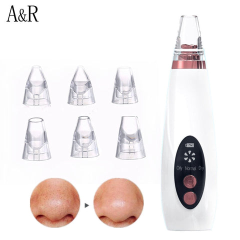 Blackhead Remover Acne Point Noir Black Head Remover Pimples Removal Aspirateur Skin Pore Cleaner Black Dot Beauty Clean Tool